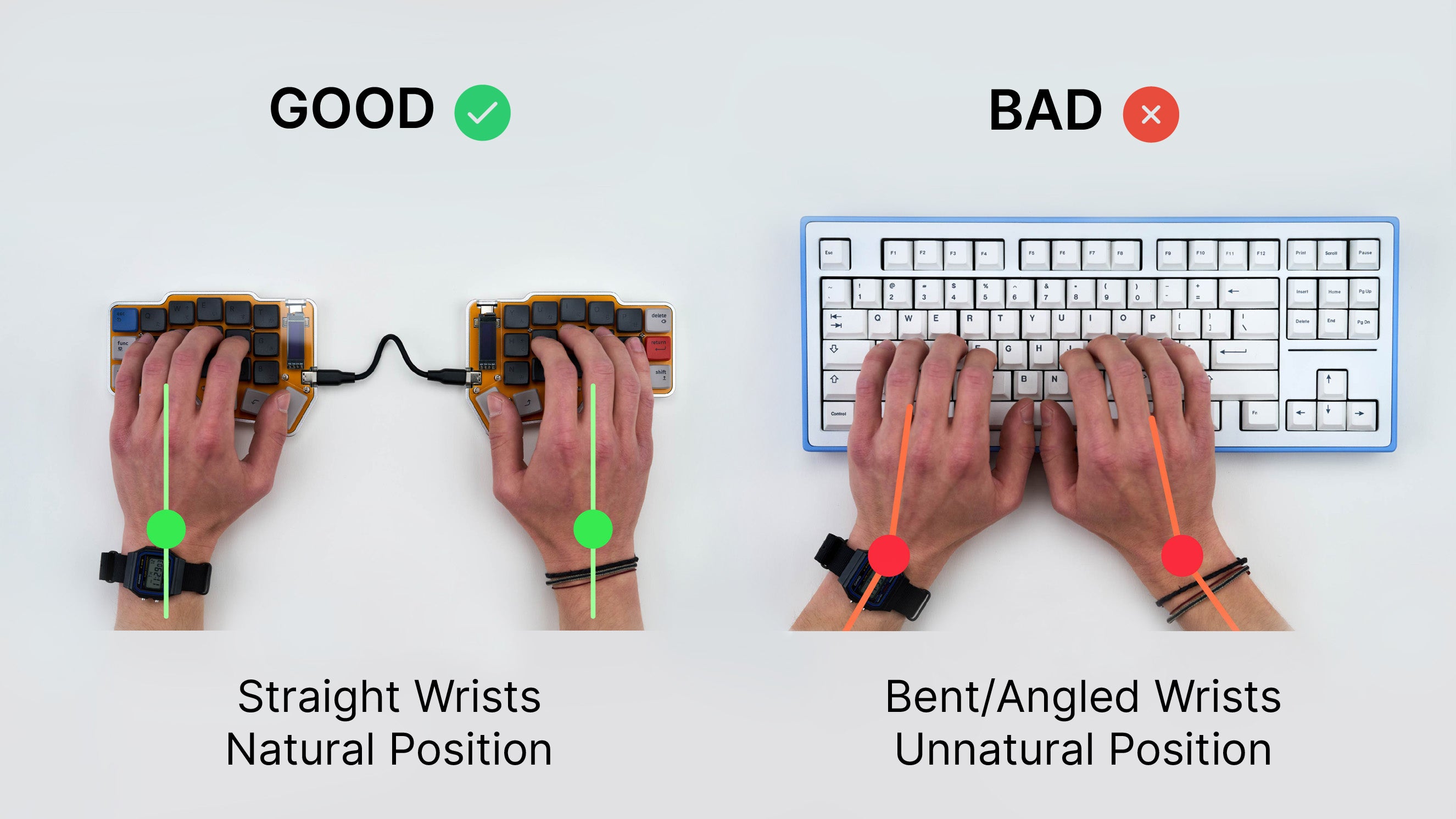 Ergonomic comparison of split keyboards